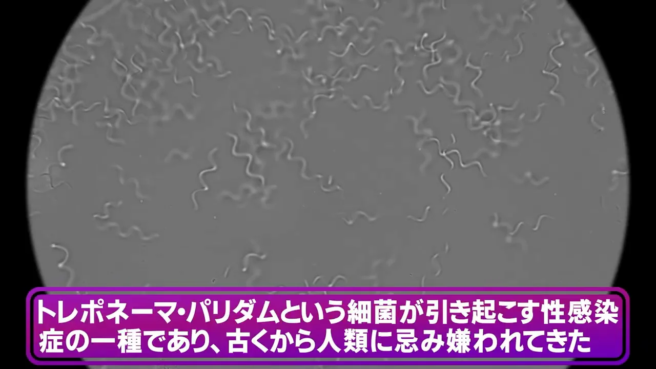 梅毒：いったん衰退した性感染症が再び増えている