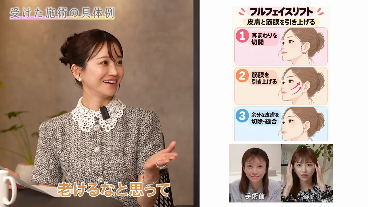 栗田玲奈の場合:フルリフト、脂肪吸引・注入、目元