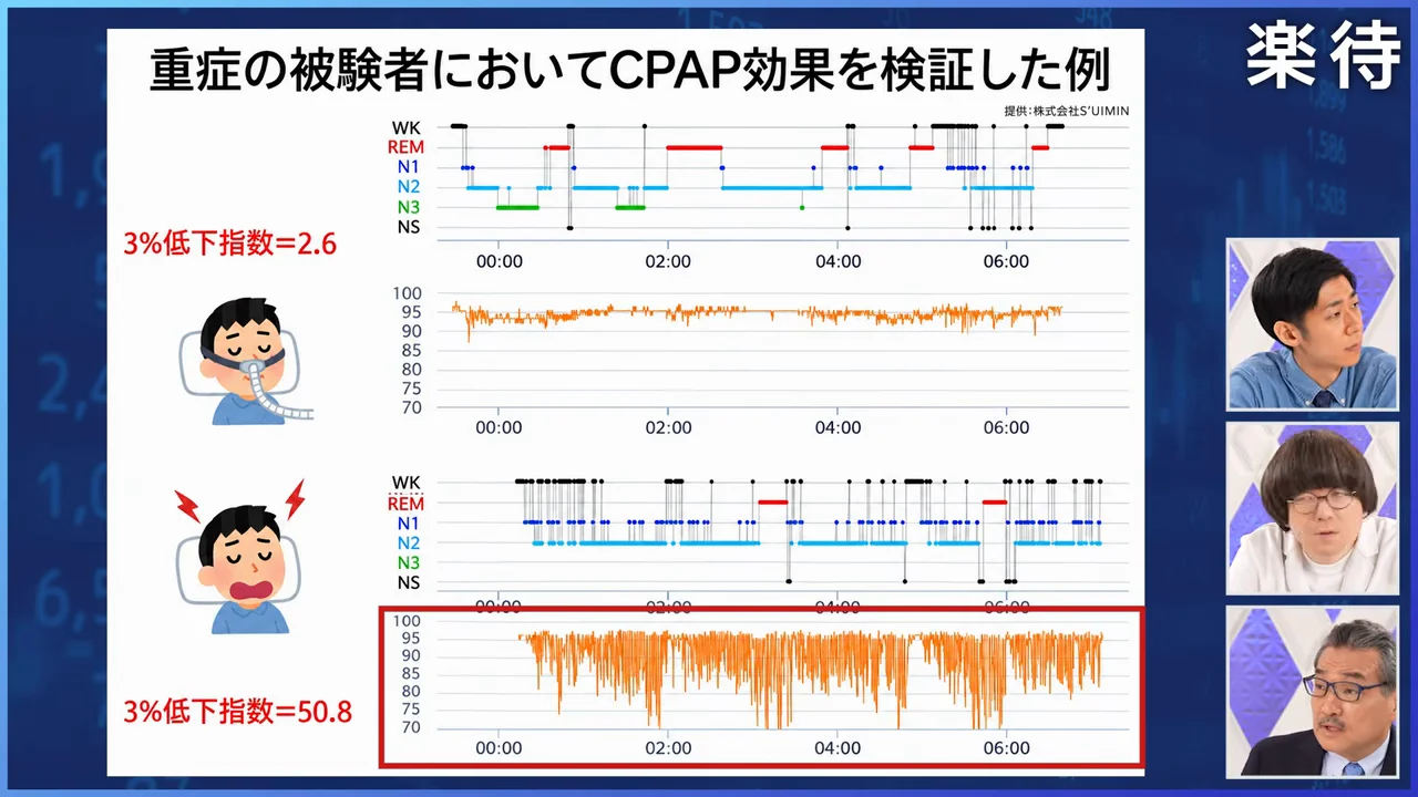 1時間に50回止まる睡眠と、CPAPで戻った睡眠