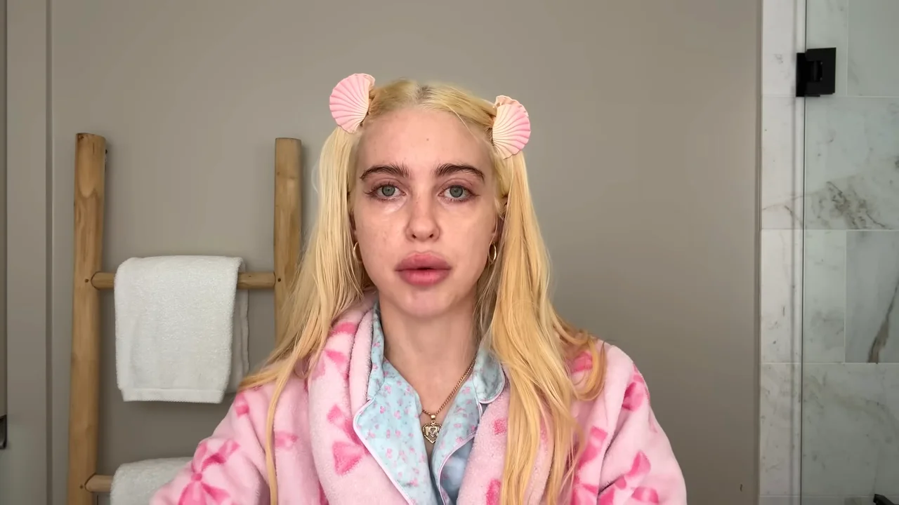 Botox and lip filler